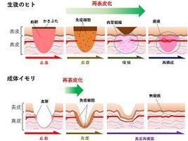 ［プレスリリース］イモリの皮膚再生過程の全容を解明 ～傷あとが残らない再生治療に向けた一歩に～