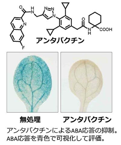 脳のMRI画像